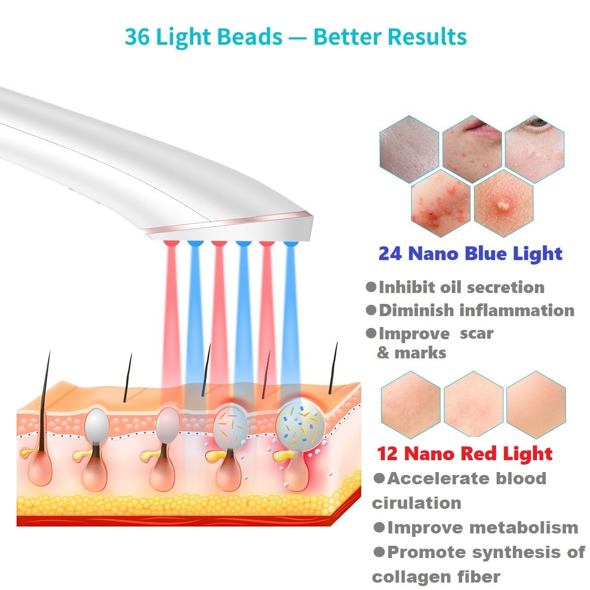 Lyte Wireless LED Light Therapy w/Hylauronic Serum