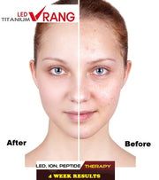LED Vrang Korean Beauty Bar System Light Therapy